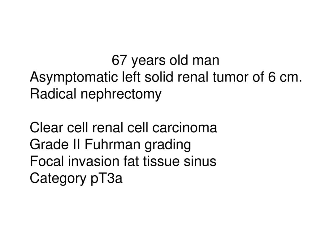 67 years old man Asymptomatic left solid renal tumor of 6 cm. Radical nephrectomy. Clear cell renal cell carcinoma.