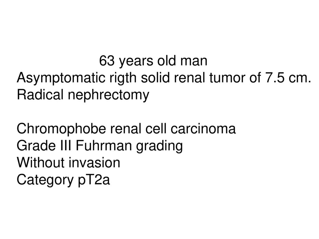 63 years old man Asymptomatic rigth solid renal tumor of 7.5 cm. Radical nephrectomy. Chromophobe renal cell carcinoma.