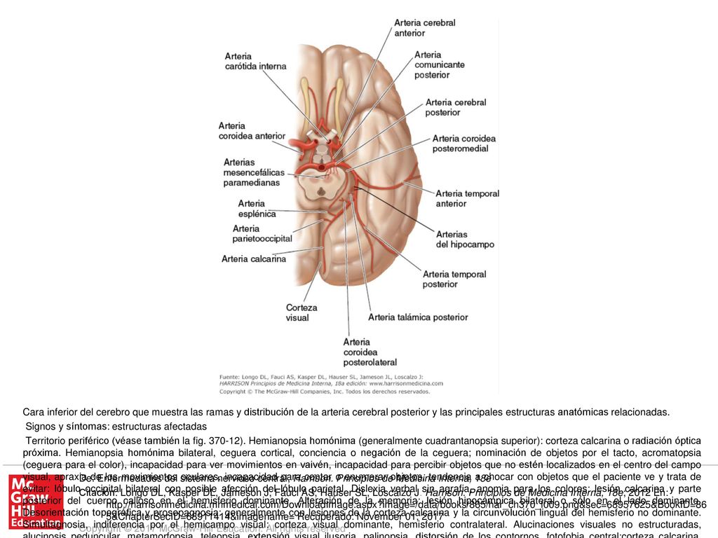 Territorio central. Síndrome talámico: pérdida de sensibilidad (todas las modalidades), dolor y disestesias espontáneos, coreoatetosis, temblor intencional, espasmos de la mano, hemiparesia leve: núcleo posteroventral del tálamo; afección del núcleo subtalámico adyacente o de sus vías aferentes. Síndrome talamoperforante: ataxia cerebelosa cruzada con parálisis ipsolateral del III par (síndrome de Claude): haz dentotalámico y III par correspondiente. Síndrome de Weber: parálisis del tercer par y hemiplejía contralateral: III par craneal y pedúnculo cerebral. Hemiplejía contralateral: pedúnculo cerebral. Parálisis o paresia de los movimientos oculares verticales, desviación oblicua, respuestas pupilares lentas a la luz, miosis y ptosis leves (se puede asociar nistagmo de retracción y cansancio de los párpados): fibras supranucleares para el III par, núcleo intersticial de Cajal, núcleo de Darkschewitsch y comisura posterior. Temblor contralateral rítmico, atáxico y de acción; temblor rítmico postural o de mantenimiento (temblor rúbrico): haz dentotalámico.