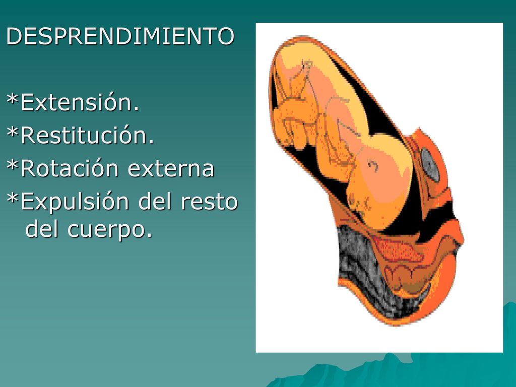 DESPRENDIMIENTO *Extensión. *Restitución. *Rotación externa *Expulsión del resto del cuerpo.