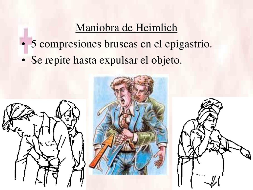 Maniobra de Heimlich 5 compresiones bruscas en el epigastrio. Se repite hasta expulsar el objeto.