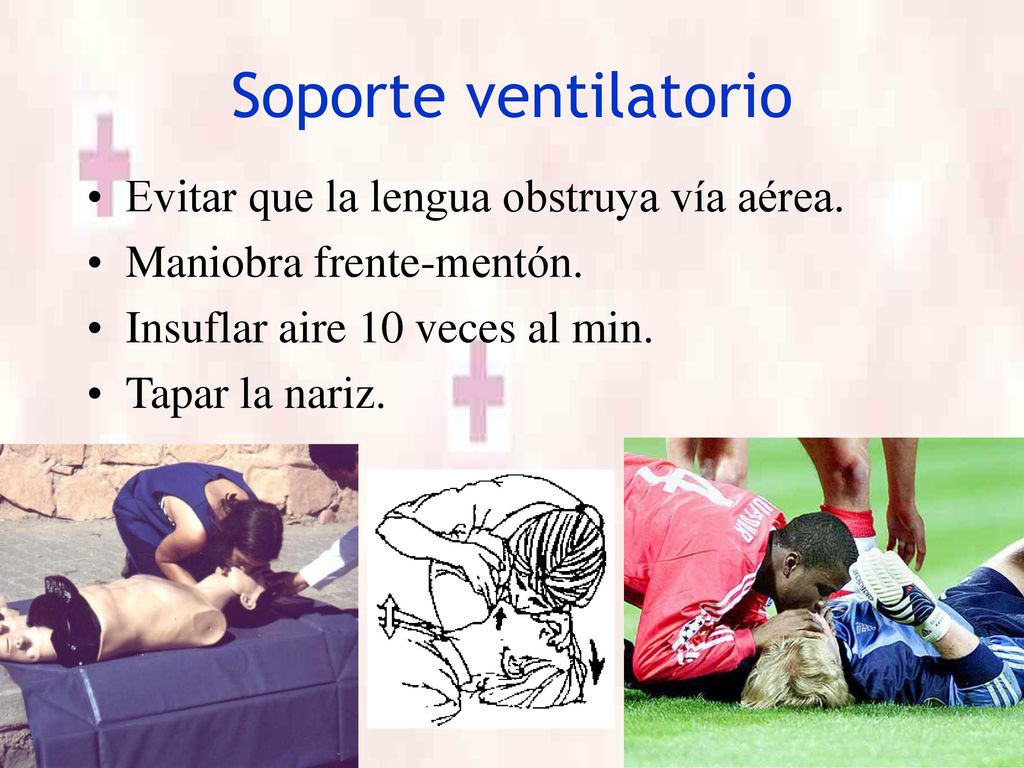 Soporte ventilatorio Evitar que la lengua obstruya vía aérea.