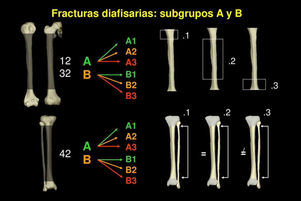A B Fracturas diafisarias: subgrupos A y B A1 A2 A3 .2 B1