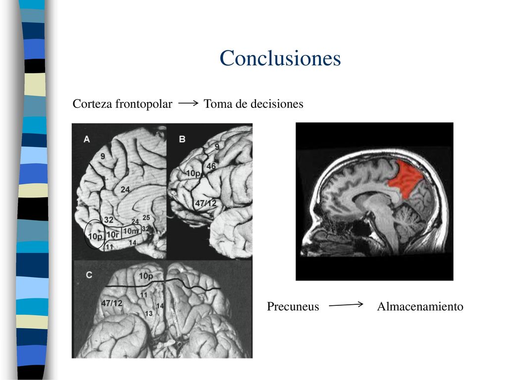 Conclusiones Corteza frontopolar Toma de decisiones Precuneus