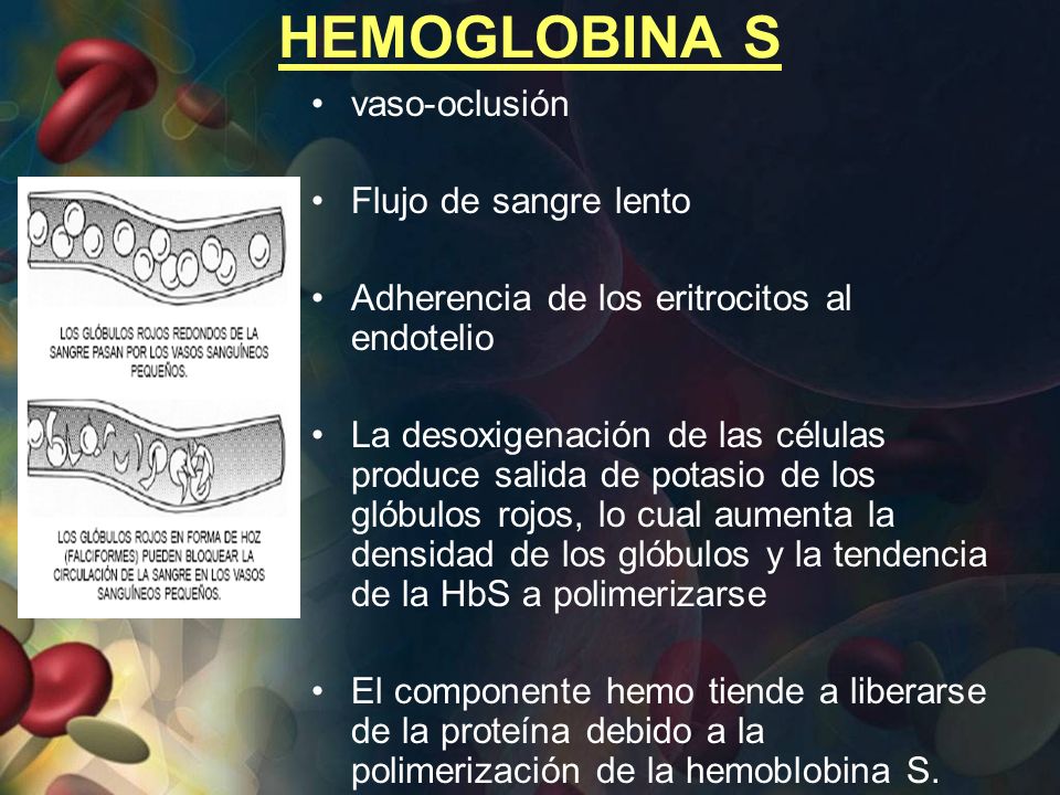 HEMOGLOBINA S vaso-oclusión Flujo de sangre lento