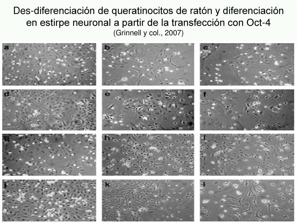 Des-diferenciación de queratinocitos de ratón y diferenciación en estirpe neuronal a partir de la transfección con Oct-4 (Grinnell y col., 2007)