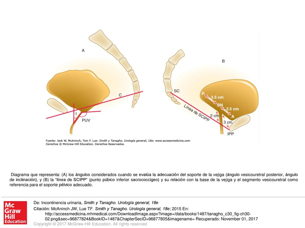 Diagrama que representa: (A) los ángulos considerados cuando se evalúa la adecuación del soporte de la vejiga (ángulo vesicouretral posterior, ángulo de inclinación), y (B) la línea de SCIPP (punto púbico inferior sacrococcígeo) y su relación con la base de la vejiga y el segmento vesicouretral como referencia para el soporte pélvico adecuado.