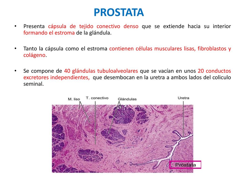 PROSTATA Presenta cápsula de tejido conectivo denso que se extiende hacia su interior formando el estroma de la glándula.