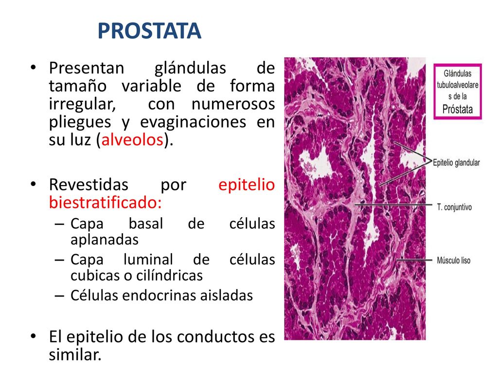 epitelio de la próstata