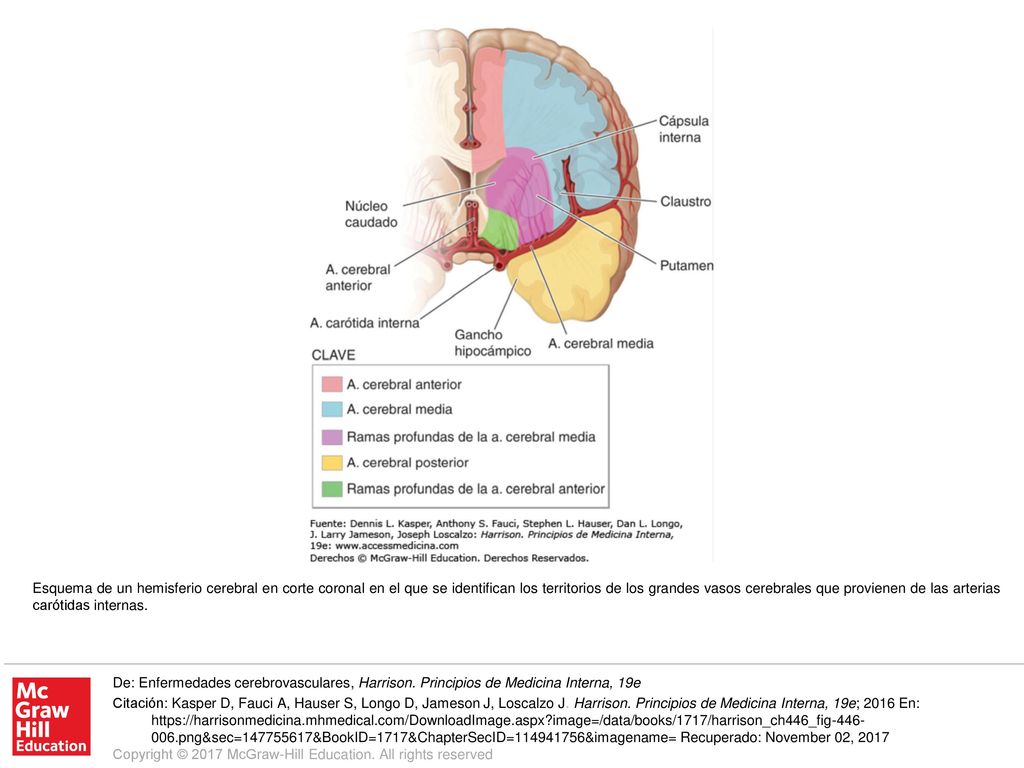 Esquema de un hemisferio cerebral en corte coronal en el que se identifican los territorios de los grandes vasos cerebrales que provienen de las arterias carótidas internas.