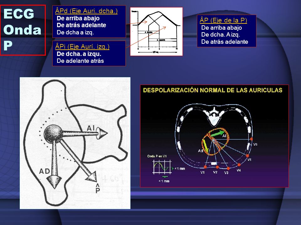 ECG Onda P ÂPd (Eje Auri. dcha.) ÂP (Eje de la P) ÂPi (Eje Aurí. izq.)