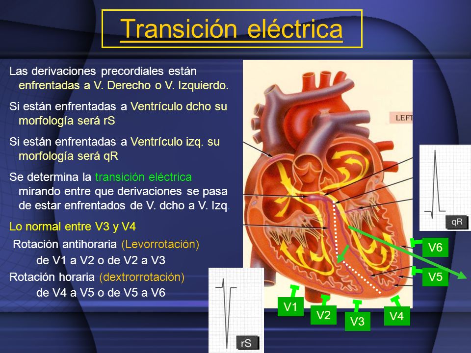 Transición eléctrica Las derivaciones precordiales están enfrentadas a V. Derecho o V. Izquierdo.
