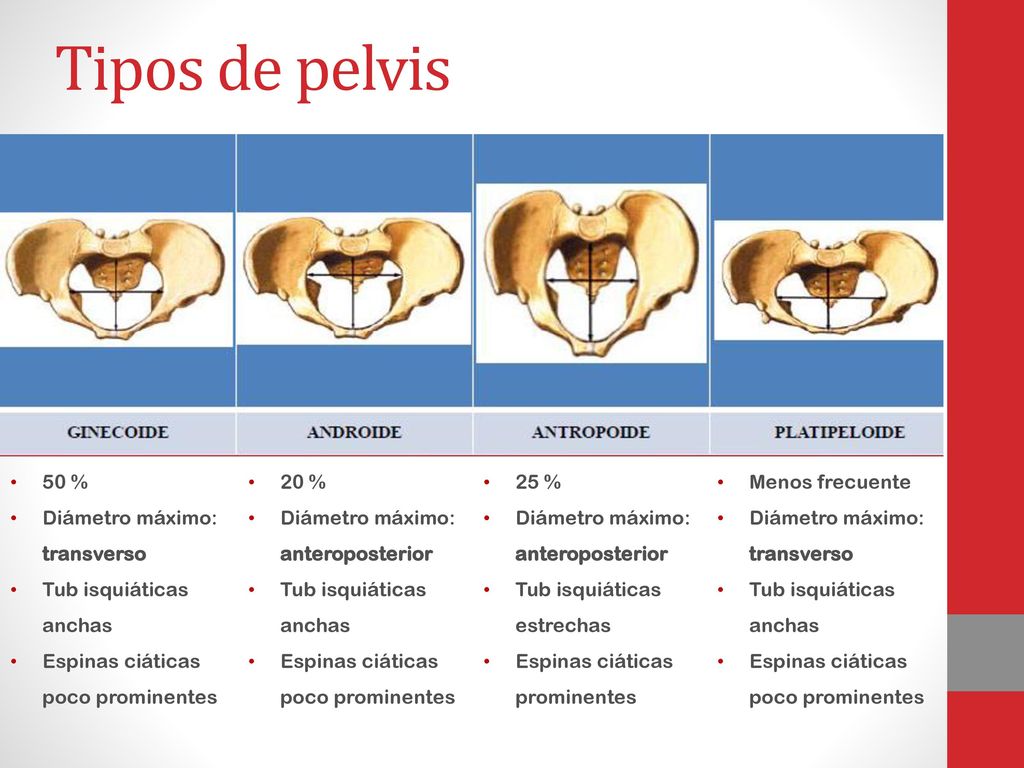 Tipos de pelvis 50 % Diámetro máximo: transverso