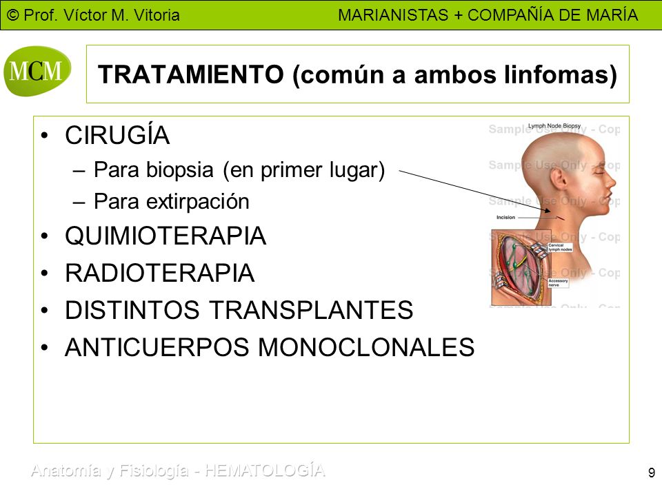 TRATAMIENTO (común a ambos linfomas)