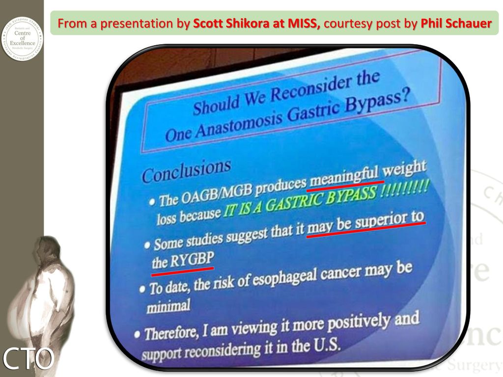 From a presentation by Scott Shikora at MISS, courtesy post by Phil Schauer