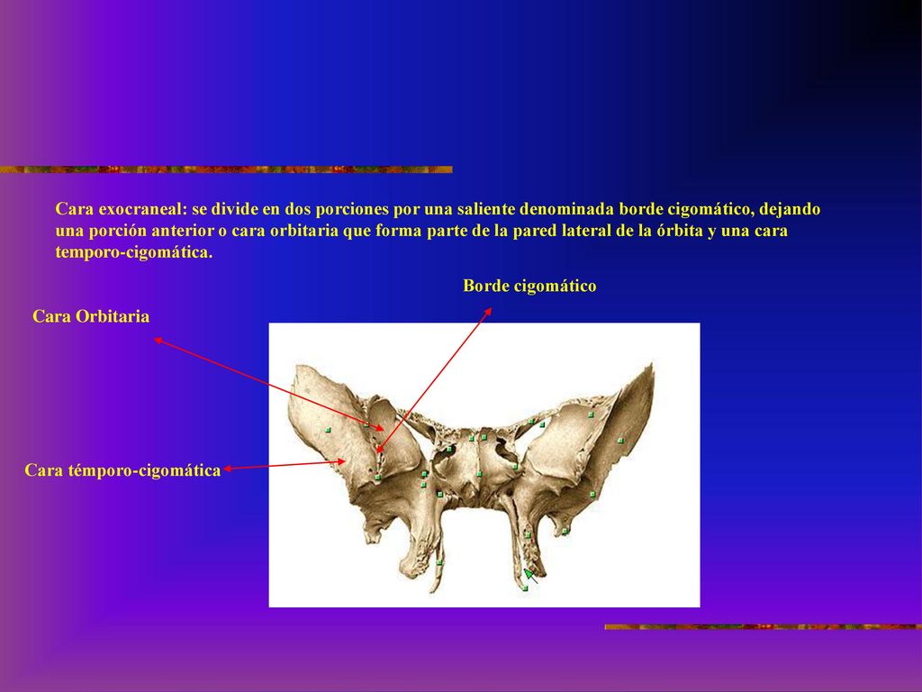 Cara exocraneal: se divide en dos porciones por una saliente denominada borde cigomático, dejando una porción anterior o cara orbitaria que forma parte de la pared lateral de la órbita y una cara temporo-cigomática.
