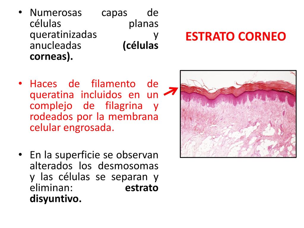 Numerosas capas de células planas queratinizadas y anucleadas (células corneas).