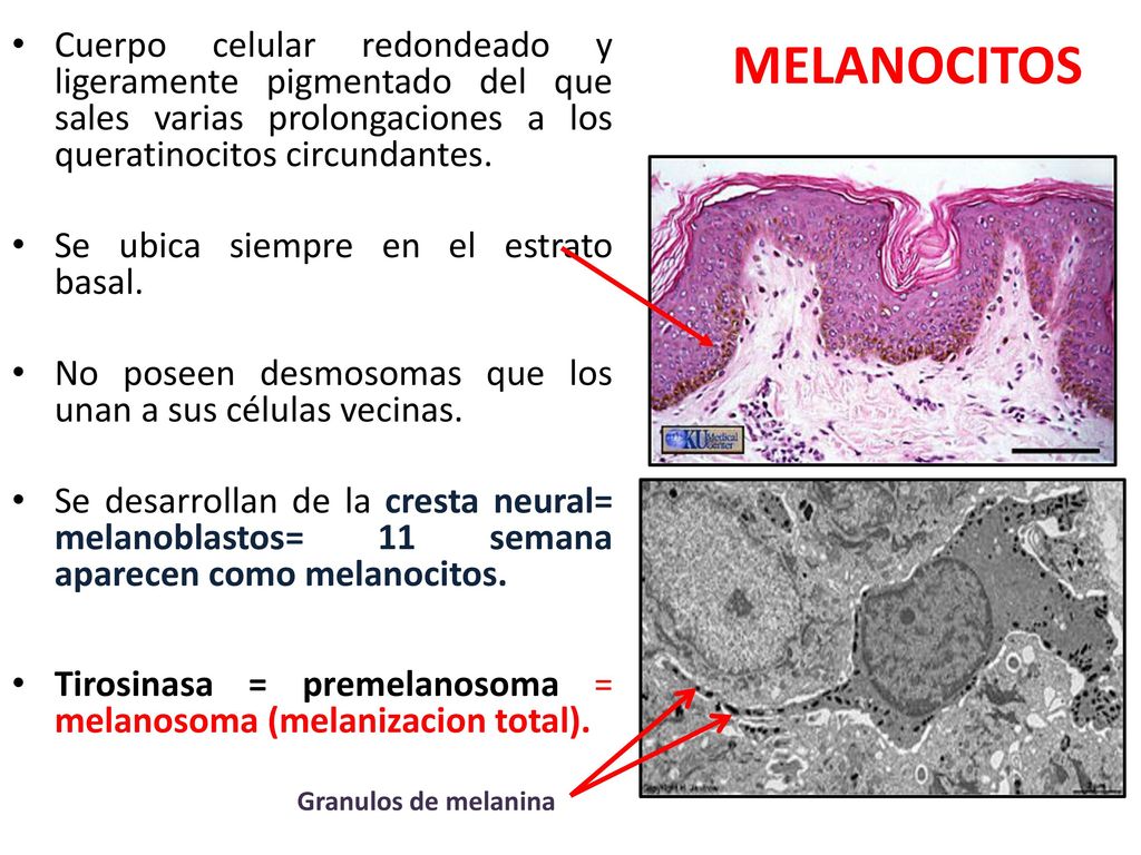 Cuerpo celular redondeado y ligeramente pigmentado del que sales varias prolongaciones a los queratinocitos circundantes.