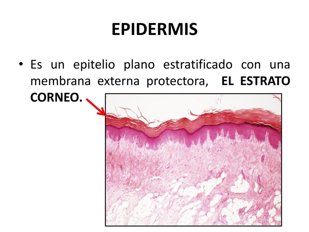 EPIDERMIS Es un epitelio plano estratificado con una membrana externa protectora, EL ESTRATO CORNEO.