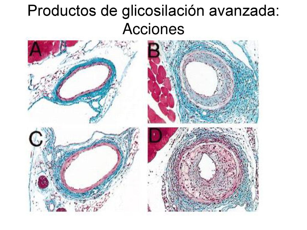 Productos de glicosilación avanzada: Acciones