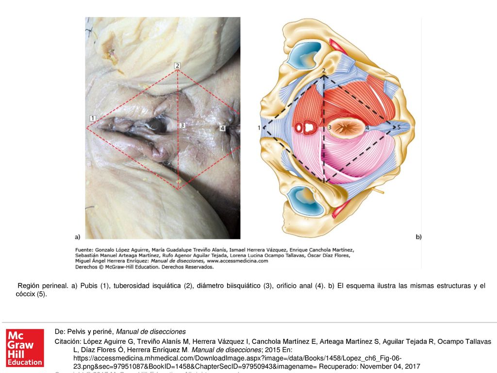Región perineal. a) Pubis (1), tuberosidad isquiática (2), diámetro biisquiático (3), orificio anal (4). b) El esquema ilustra las mismas estructuras y el cóccix (5).