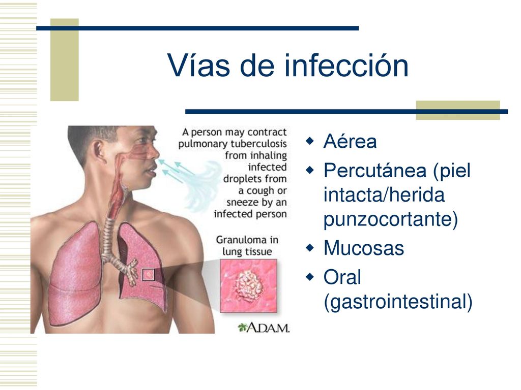 Vías de infección Aérea Percutánea (piel intacta/herida punzocortante)