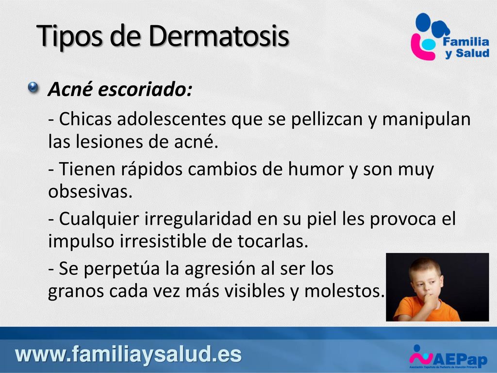 Tipos de Dermatosis Acné escoriado: