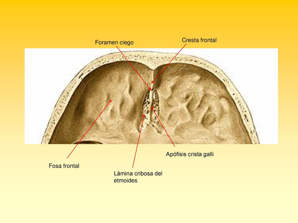 Cresta frontal Foramen ciego Apófisis crista galli Fosa frontal Lámina cribosa del etmoides