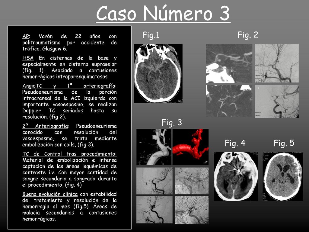 Caso Número 3 Fig.1 Fig. 2 Fig. 3 Fig. 4 Fig. 5
