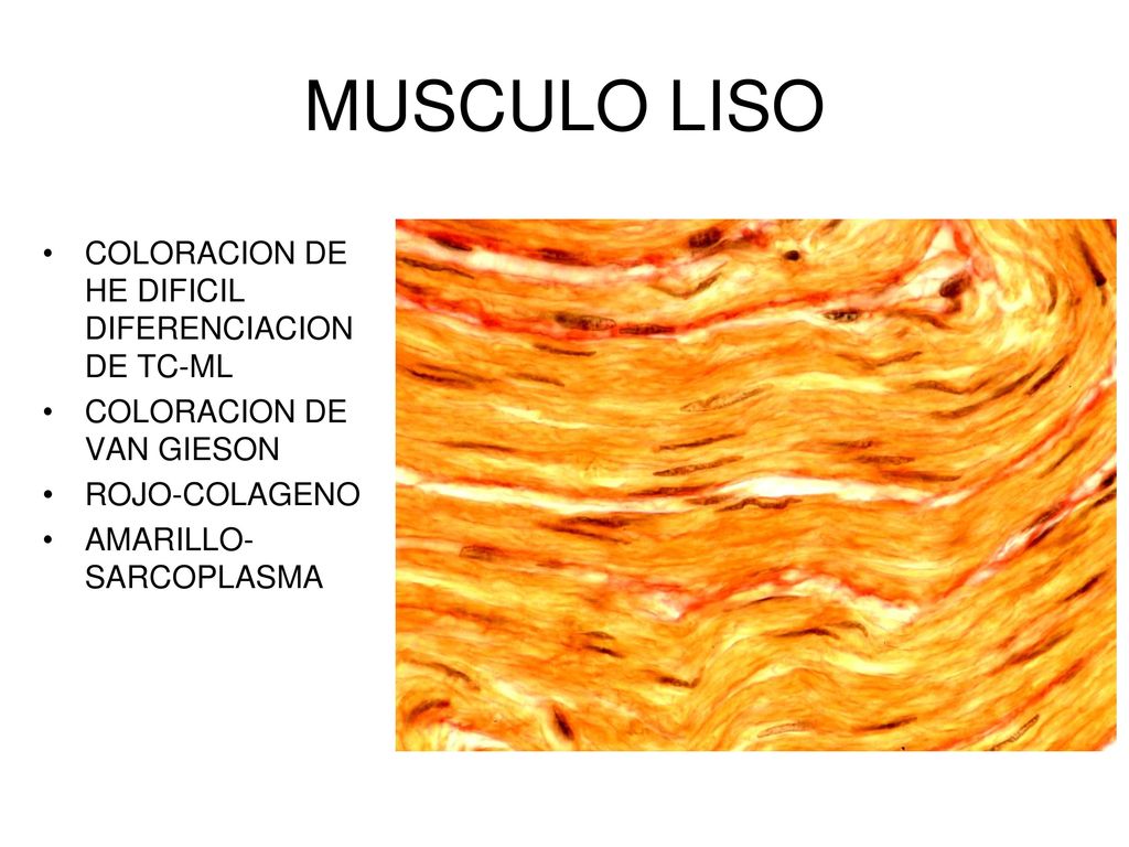 MUSCULO LISO COLORACION DE HE DIFICIL DIFERENCIACION DE TC-ML