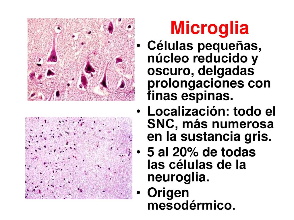 Microglia Células pequeñas, núcleo reducido y oscuro, delgadas prolongaciones con finas espinas.