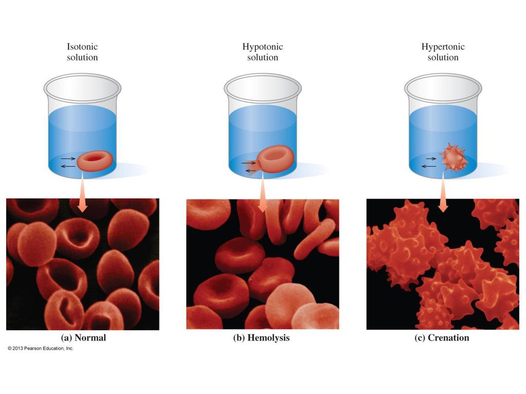 Figure 8.10 (a) In an isotonic solution, a red blood cell retains its normal volume.