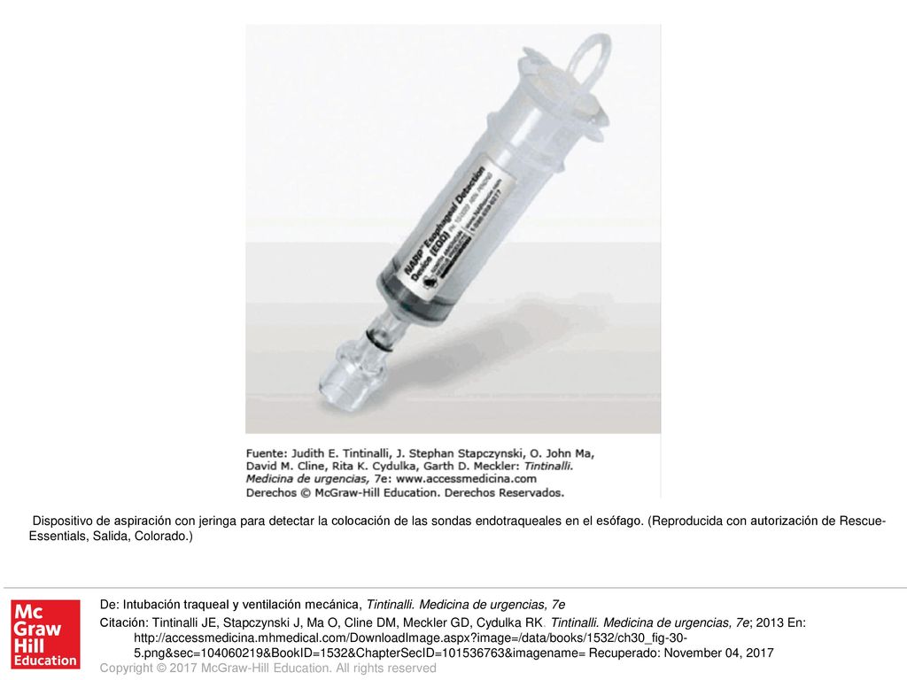 Dispositivo de aspiración con jeringa para detectar la colocación de las sondas endotraqueales en el esófago. (Reproducida con autorización de Rescue-Essentials, Salida, Colorado.)