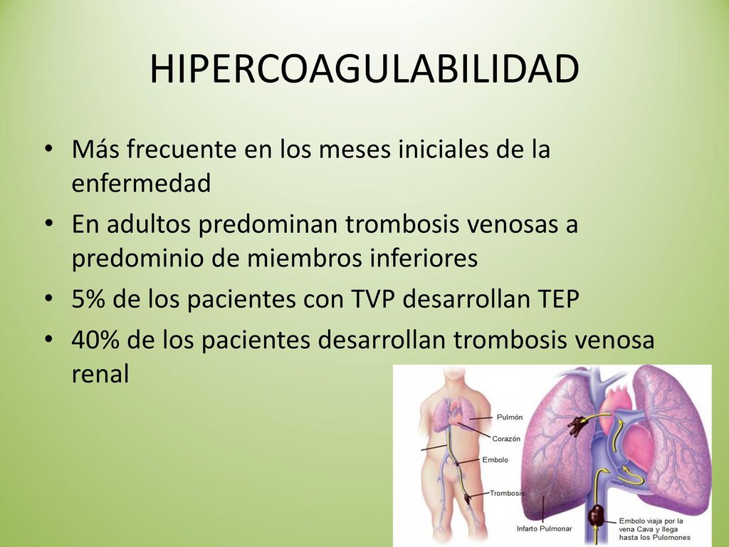 HIPERCOAGULABILIDAD Más frecuente en los meses iniciales de la enfermedad.