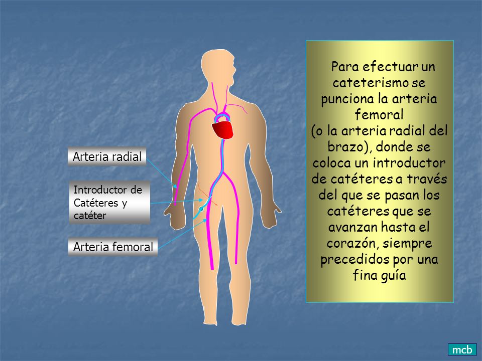 Para efectuar un cateterismo se punciona la arteria femoral