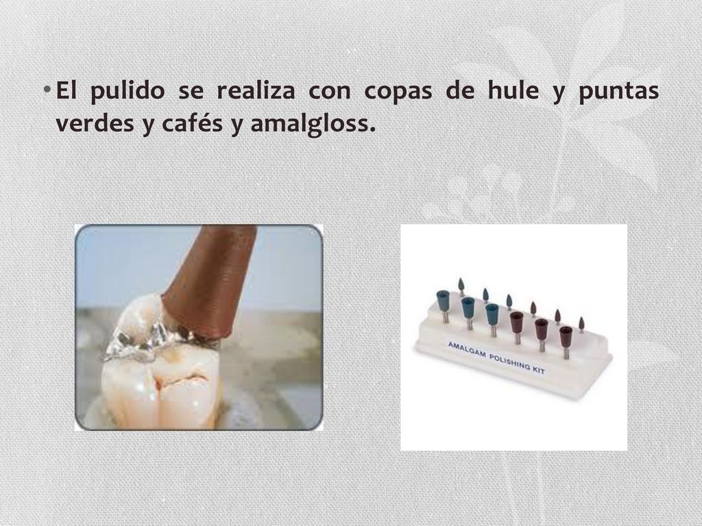 El pulido se realiza con copas de hule y puntas verdes y cafés y amalgloss.