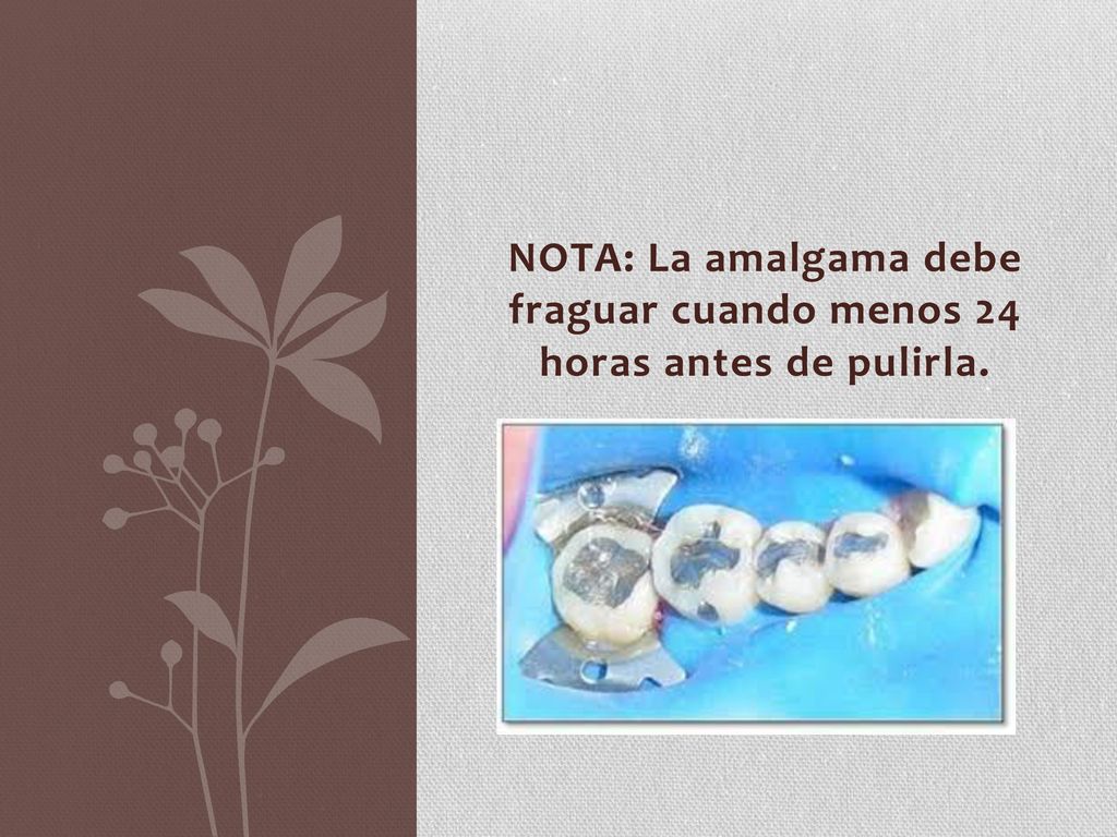 NOTA: La amalgama debe fraguar cuando menos 24 horas antes de pulirla.