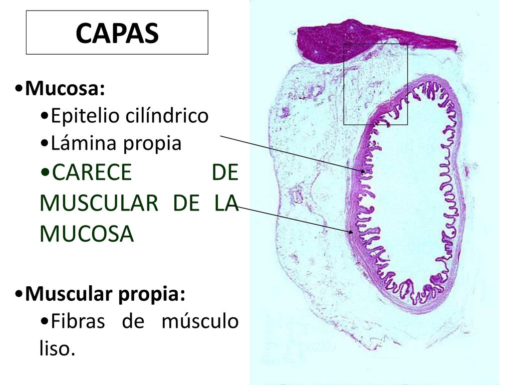 CAPAS CARECE DE MUSCULAR DE LA MUCOSA Mucosa: Epitelio cilíndrico