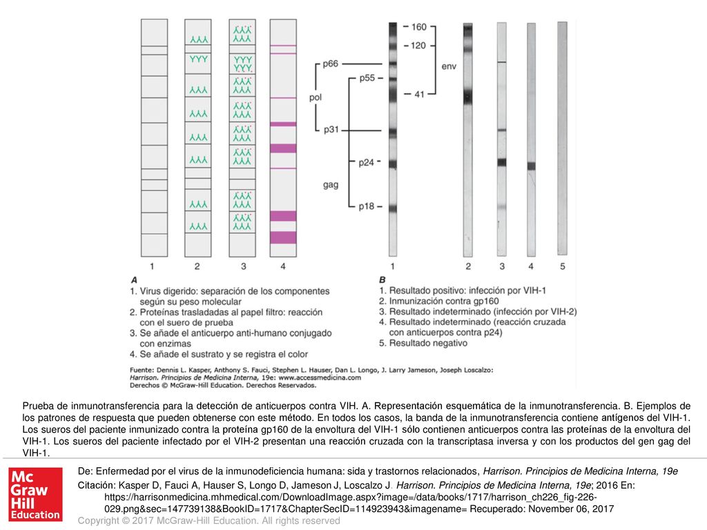Prueba de inmunotransferencia para la detección de anticuerpos contra VIH. A. Representación esquemática de la inmunotransferencia. B. Ejemplos de los patrones de respuesta que pueden obtenerse con este método. En todos los casos, la banda de la inmunotransferencia contiene antígenos del VIH-1. Los sueros del paciente inmunizado contra la proteína gp160 de la envoltura del VIH-1 sólo contienen anticuerpos contra las proteínas de la envoltura del VIH-1. Los sueros del paciente infectado por el VIH-2 presentan una reacción cruzada con la transcriptasa inversa y con los productos del gen gag del VIH-1.