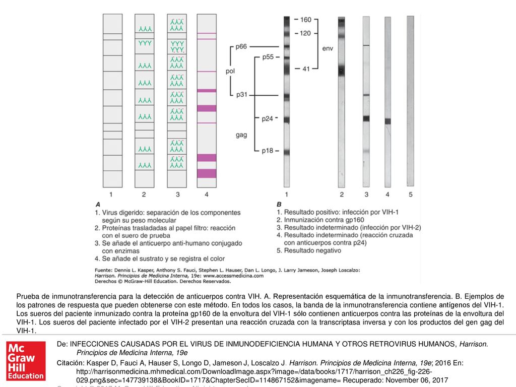 Prueba de inmunotransferencia para la detección de anticuerpos contra VIH. A. Representación esquemática de la inmunotransferencia. B. Ejemplos de los patrones de respuesta que pueden obtenerse con este método. En todos los casos, la banda de la inmunotransferencia contiene antígenos del VIH-1. Los sueros del paciente inmunizado contra la proteína gp160 de la envoltura del VIH-1 sólo contienen anticuerpos contra las proteínas de la envoltura del VIH-1. Los sueros del paciente infectado por el VIH-2 presentan una reacción cruzada con la transcriptasa inversa y con los productos del gen gag del VIH-1.