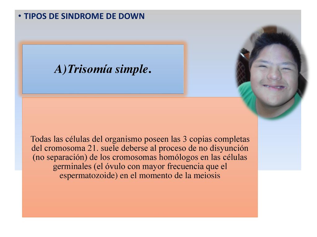 A)Trisomía simple. TIPOS DE SINDROME DE DOWN