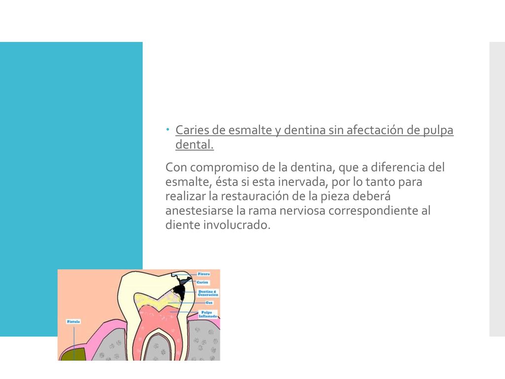 Caries de esmalte y dentina sin afectación de pulpa dental.