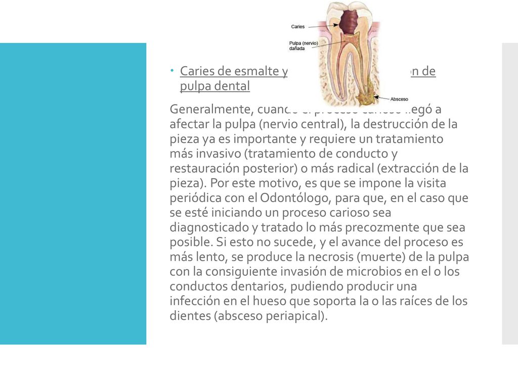 Caries de esmalte y dentina con afectación de pulpa dental