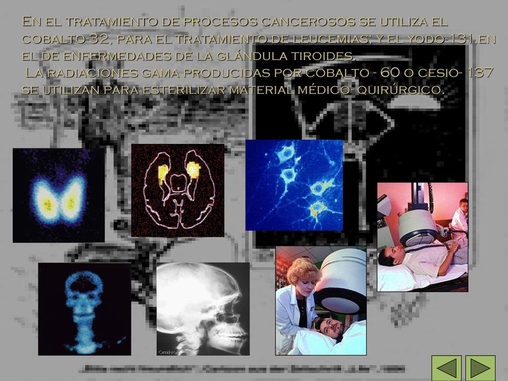 En el tratamiento de procesos cancerosos se utiliza el cobalto-32, para el tratamiento de leucemias; y el yodo-131,en el de enfermedades de la glándula tiroides.