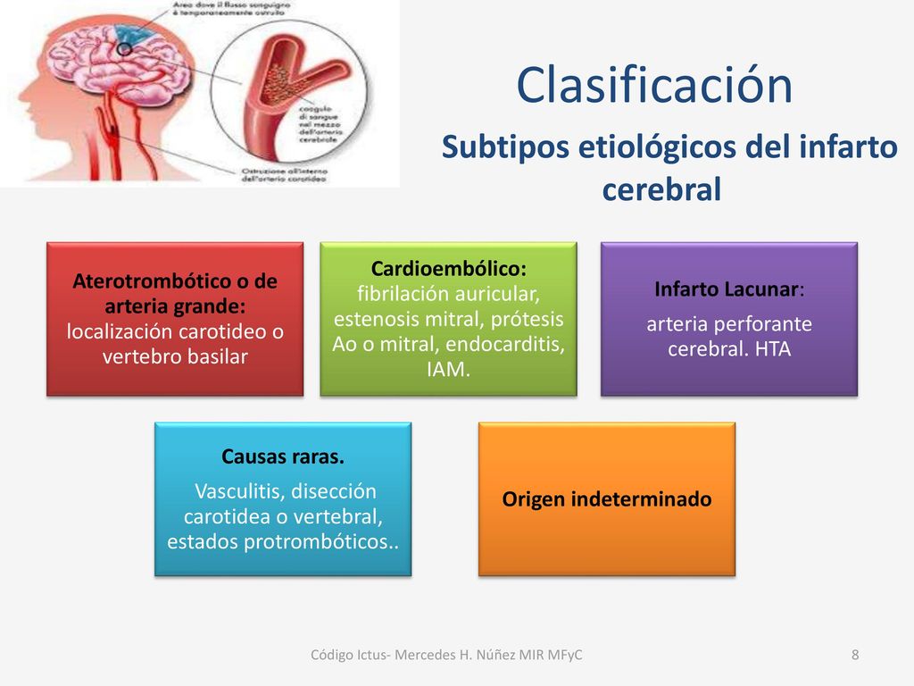 Clasificación Subtipos etiológicos del infarto cerebral