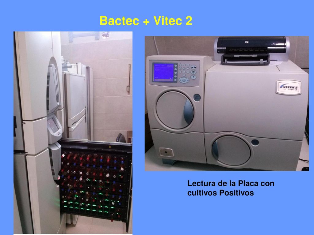 Bactec + Vitec 2 Lectura de la Placa con cultivos Positivos
