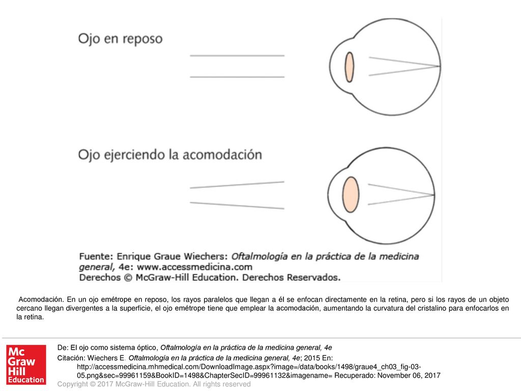 Acomodación. En un ojo emétrope en reposo, los rayos paralelos que llegan a él se enfocan directamente en la retina, pero si los rayos de un objeto cercano llegan divergentes a la superficie, el ojo emétrope tiene que emplear la acomodación, aumentando la curvatura del cristalino para enfocarlos en la retina.