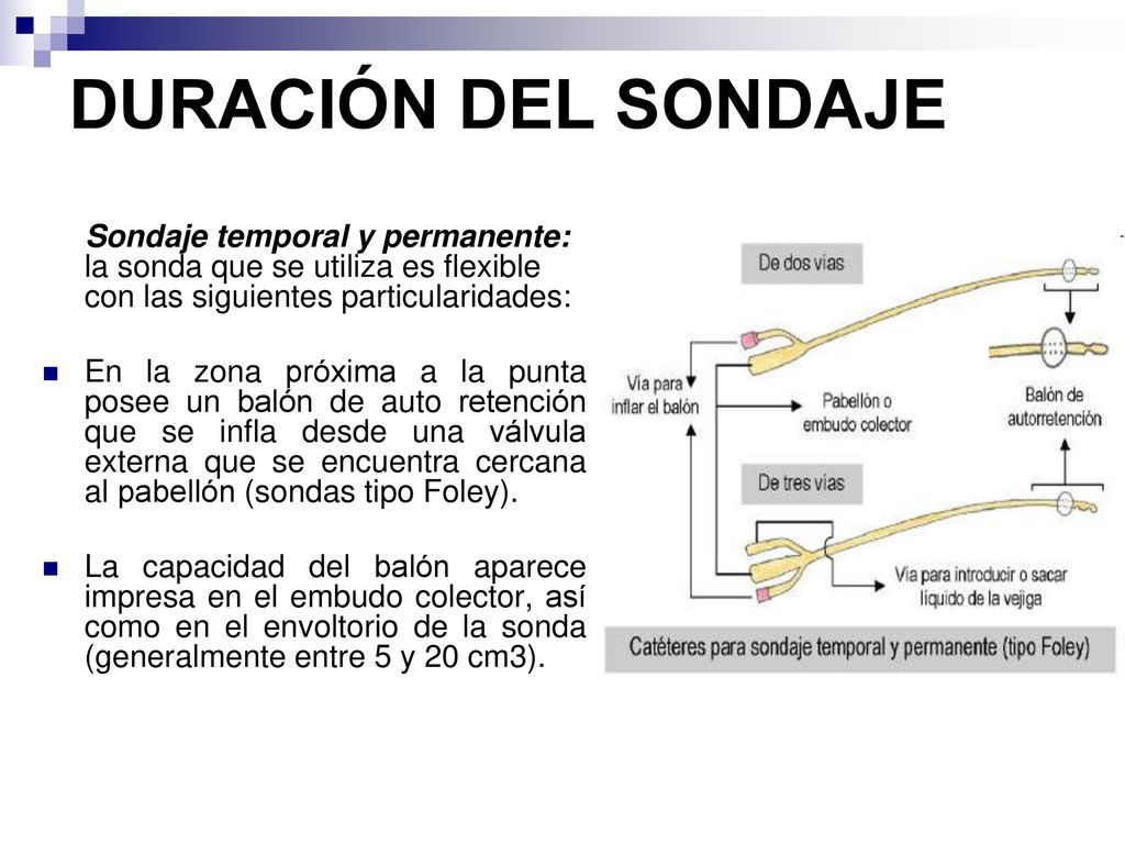 DURACIÓN DEL SONDAJE Sondaje temporal y permanente: la sonda que se utiliza es flexible con las siguientes particularidades: