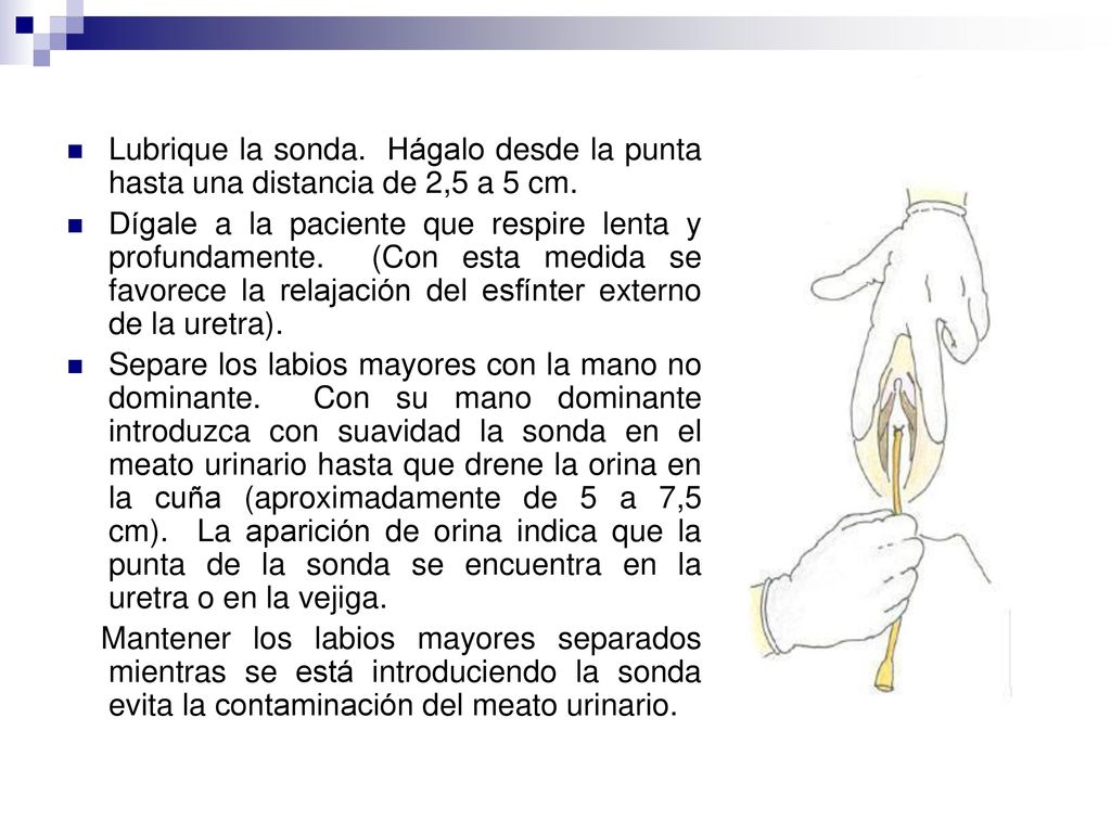 Lubrique la sonda. Hágalo desde la punta hasta una distancia de 2,5 a 5 cm.