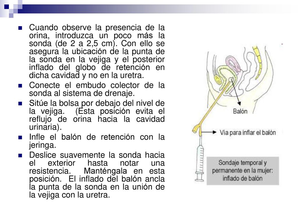 Cuando observe la presencia de la orina, introduzca un poco más la sonda (de 2 a 2,5 cm). Con ello se asegura la ubicación de la punta de la sonda en la vejiga y el posterior inflado del globo de retención en dicha cavidad y no en la uretra.